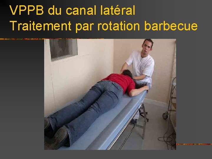 VPPB du canal latéral Traitement par rotation barbecue 