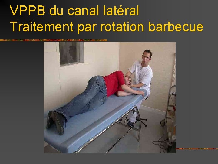 VPPB du canal latéral Traitement par rotation barbecue 