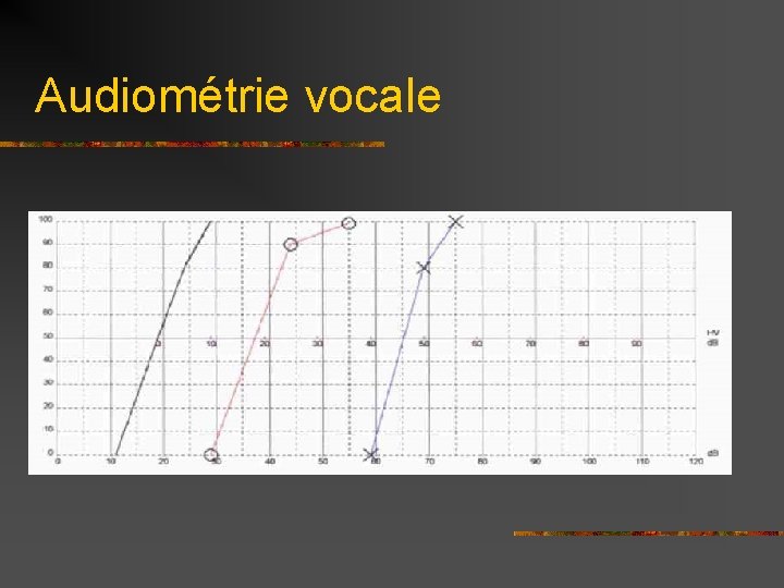 Audiométrie vocale % 