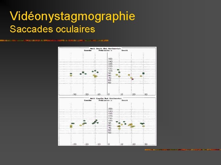 Vidéonystagmographie Saccades oculaires 
