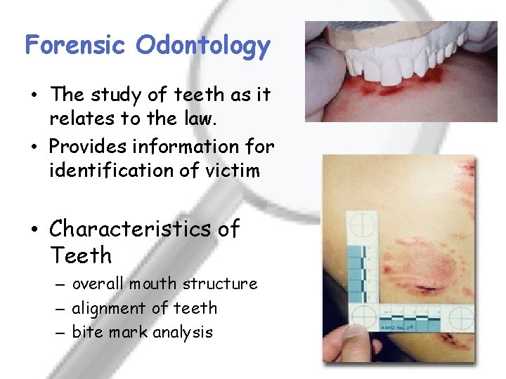 Forensic Odontology • The study of teeth as it relates to the law. •