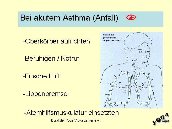 Bei akutem Asthma (Anfall) -Oberkörper aufrichten -Beruhigen / Notruf -Frische Luft -Lippenbremse -Atemhilfsmuskulatur einsetzten