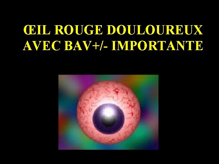 ŒIL ROUGE DOULOUREUX AVEC BAV+/- IMPORTANTE 