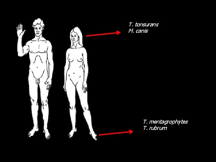 T. tonsurans M. canis T. mentagrophytes T. rubrum 