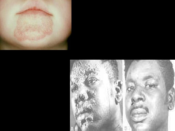 Nosologia y Clinica de Dermatologia 39 