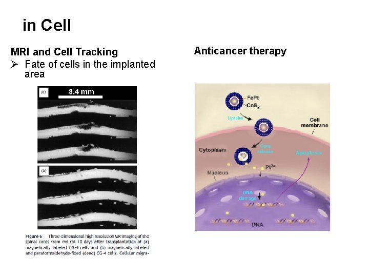in Cell MRI and Cell Tracking Ø Fate of cells in the implanted area