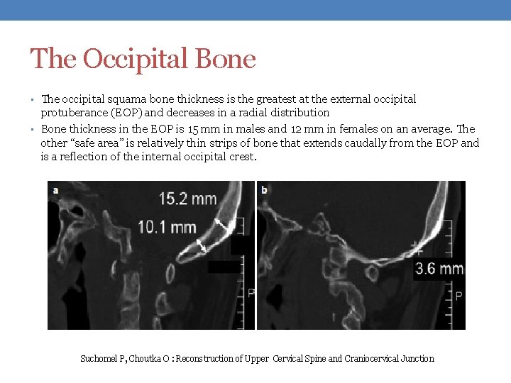 The Occipital Bone • The occipital squama bone thickness is the greatest at the