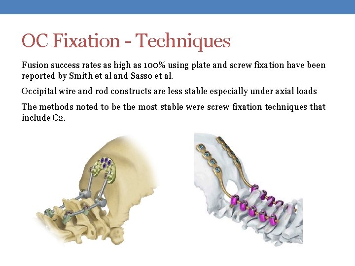 OC Fixation - Techniques Fusion success rates as high as 100% using plate and
