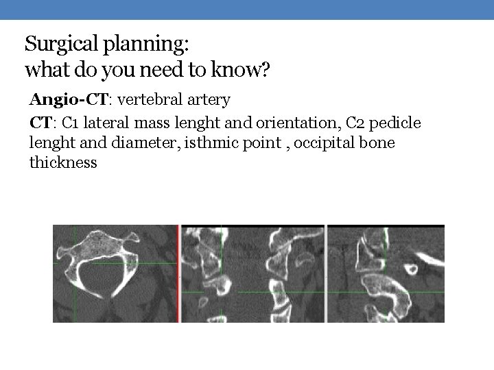 Surgical planning: what do you need to know? Angio-CT: vertebral artery CT: C 1