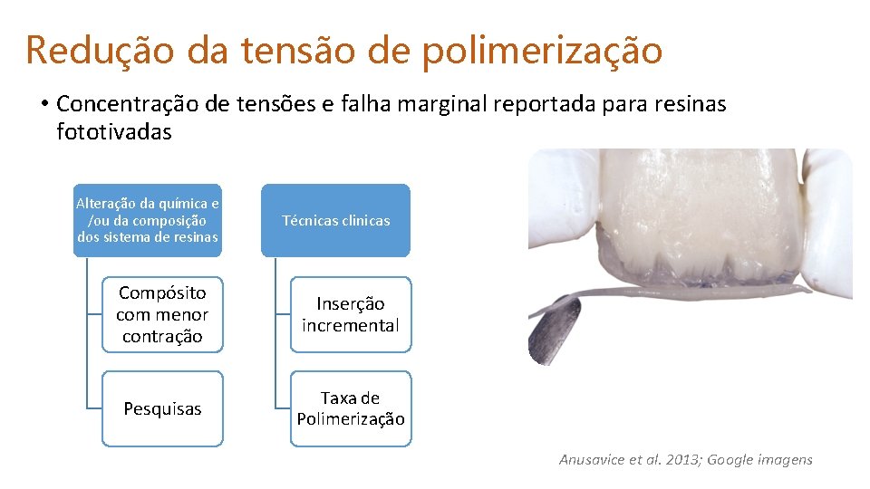 Redução da tensão de polimerização • Concentração de tensões e falha marginal reportada para