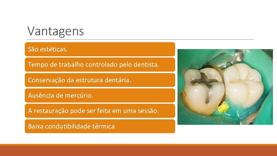 Vantagens São estéticas. Tempo de trabalho controlado pelo dentista. Conservação da estrutura dentária. Ausência