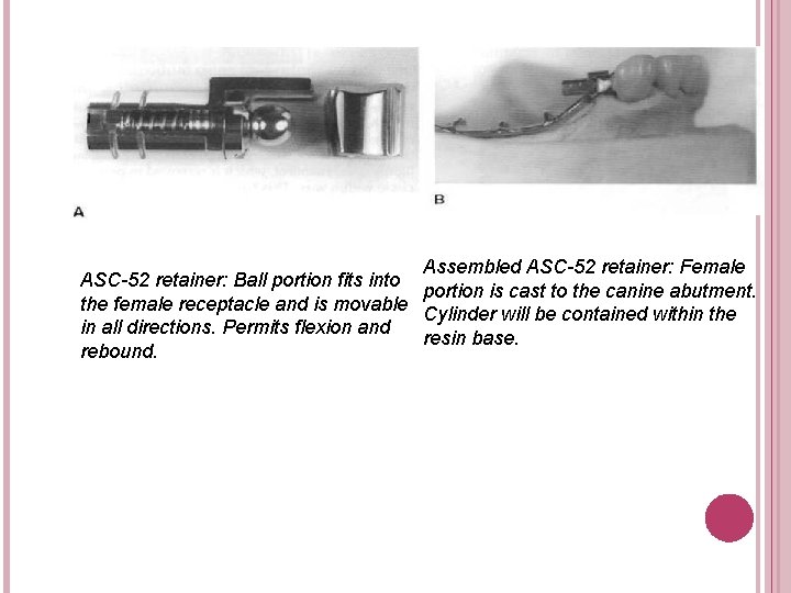 Assembled ASC-52 retainer: Female ASC-52 retainer: Ball portion fits into portion is cast to