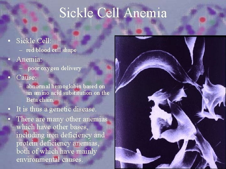 Sickle Cell Anemia • Sickle Cell: – red blood cell shape • Anemia: –