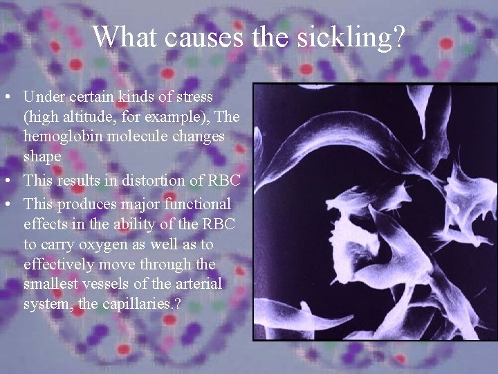 What causes the sickling? • Under certain kinds of stress (high altitude, for example),