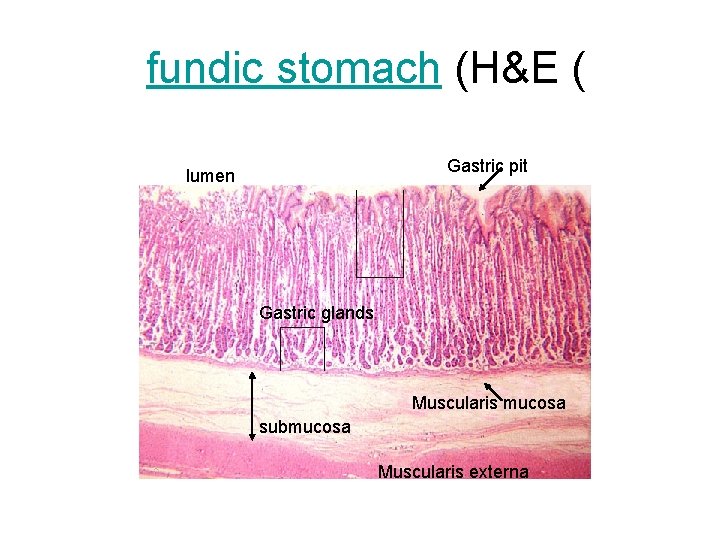 fundic stomach (H&E ( Gastric pit lumen Gastric glands Muscularis mucosa submucosa Muscularis externa