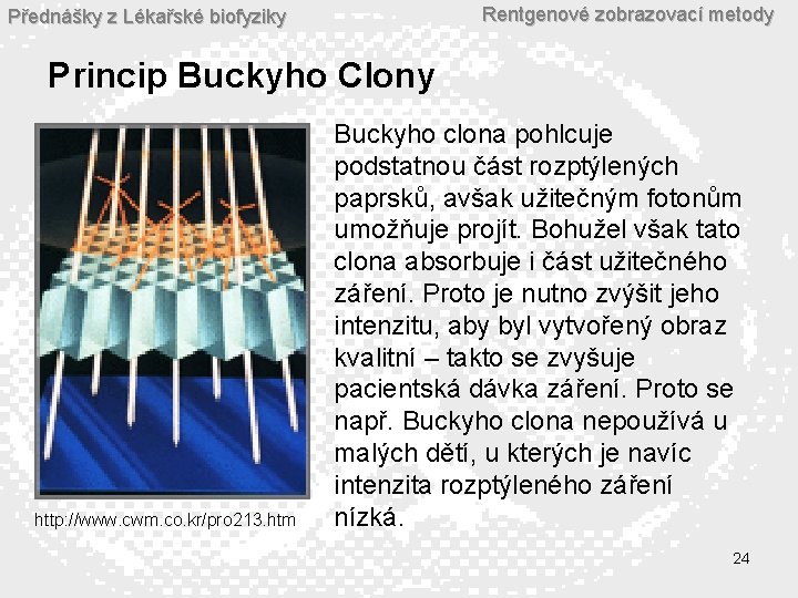 Rentgenové zobrazovací metody Přednášky z Lékařské biofyziky Princip Buckyho Clony http: //www. cwm. co.