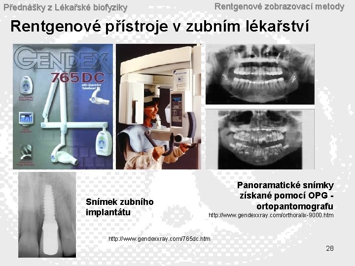 Rentgenové zobrazovací metody Přednášky z Lékařské biofyziky Rentgenové přístroje v zubním lékařství Snímek zubního