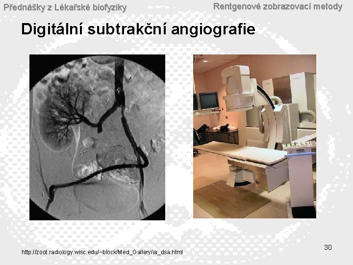 Přednášky z Lékařské biofyziky Rentgenové zobrazovací metody Digitální subtrakční angiografie http: //zoot. radiology. wisc.