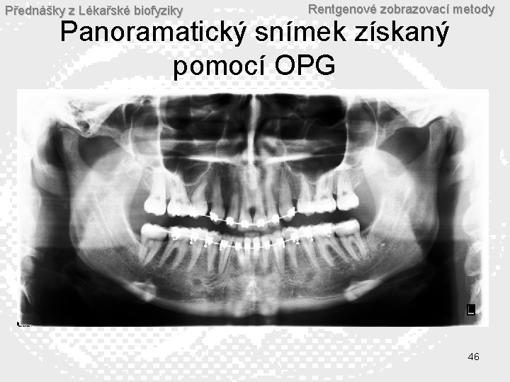 Přednášky z Lékařské biofyziky Rentgenové zobrazovací metody Panoramatický snímek získaný pomocí OPG 46 