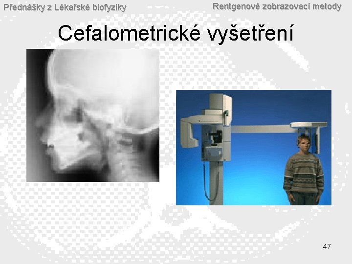 Přednášky z Lékařské biofyziky Rentgenové zobrazovací metody Cefalometrické vyšetření 47 