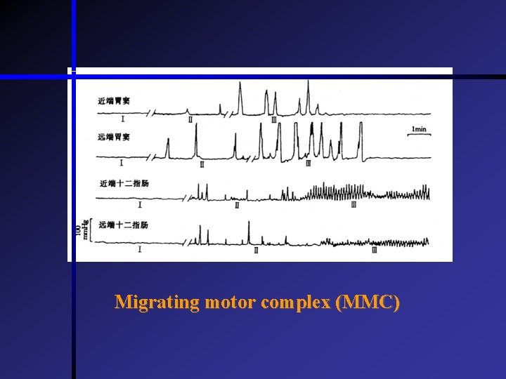 Migrating motor complex (MMC)  Migrating motor complex (MMC)