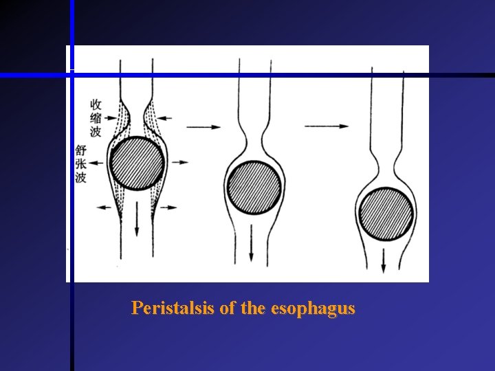 Peristalsis of the esophagus  Peristalsis of the esophagus