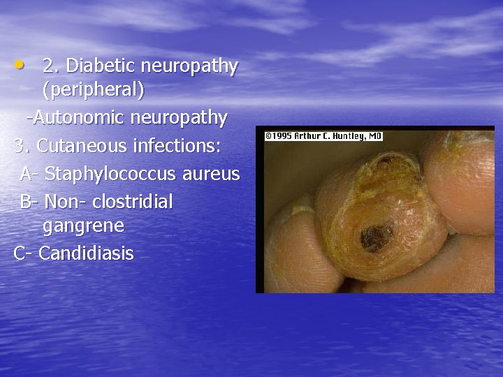 • 2. Diabetic neuropathy (peripheral) -Autonomic neuropathy 3. Cutaneous infections: A- Staphylococcus aureus