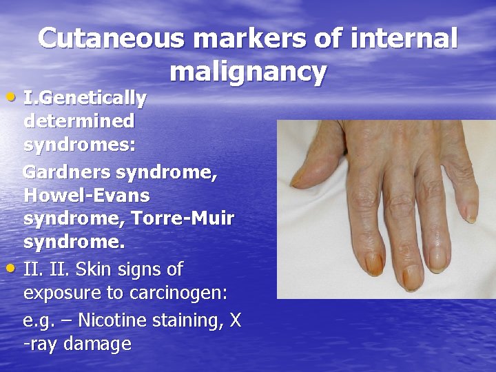 Cutaneous markers of internal malignancy • I. Genetically determined syndromes: Gardners syndrome, Howel-Evans syndrome,