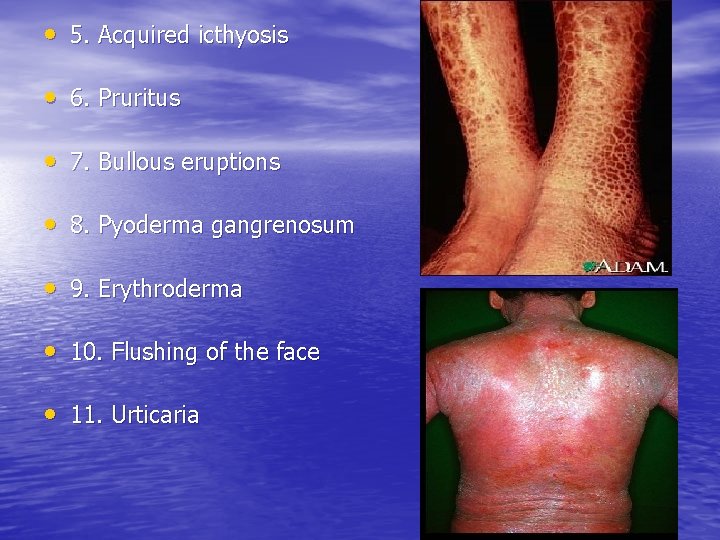  • 5. Acquired icthyosis • 6. Pruritus • 7. Bullous eruptions • 8.