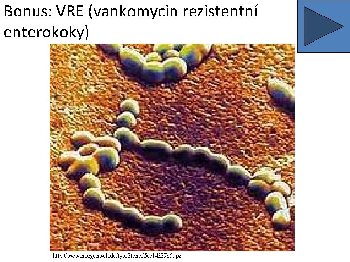 Bonus: VRE (vankomycin rezistentní enterokoky) http: //www. morgenwelt. de/typo 3 temp/5 ce 14 d