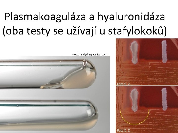 Plasmakoaguláza a hyaluronidáza (oba testy se užívají u stafylokoků) www. hardydiagnostics. com Foto O.