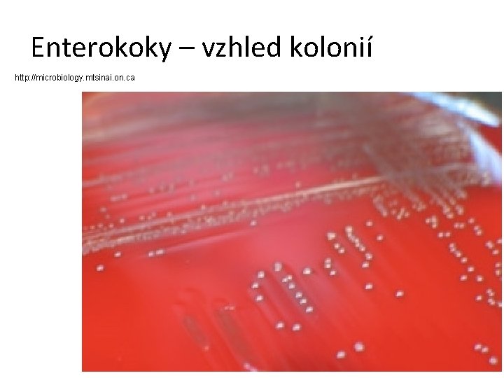 Enterokoky – vzhled kolonií http: //microbiology. mtsinai. on. ca 