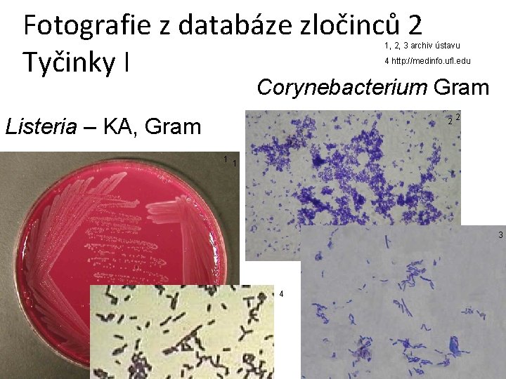 Fotografie z databáze zločinců 2 Tyčinky I 1, 2, 3 archiv ústavu 4 http: