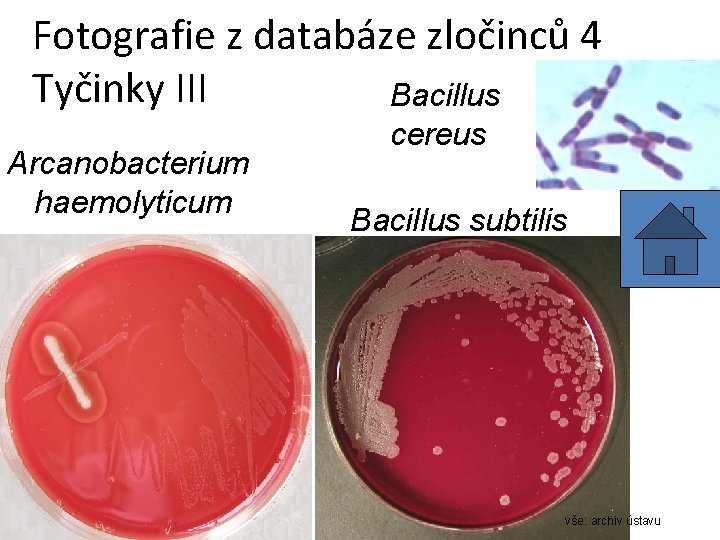 Fotografie z databáze zločinců 4 Tyčinky III Bacillus Arcanobacterium haemolyticum cereus Bacillus subtilis vše: