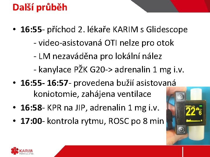 Další průběh • 16: 55 - příchod 2. lékaře KARIM s Glidescope - video-asistovaná