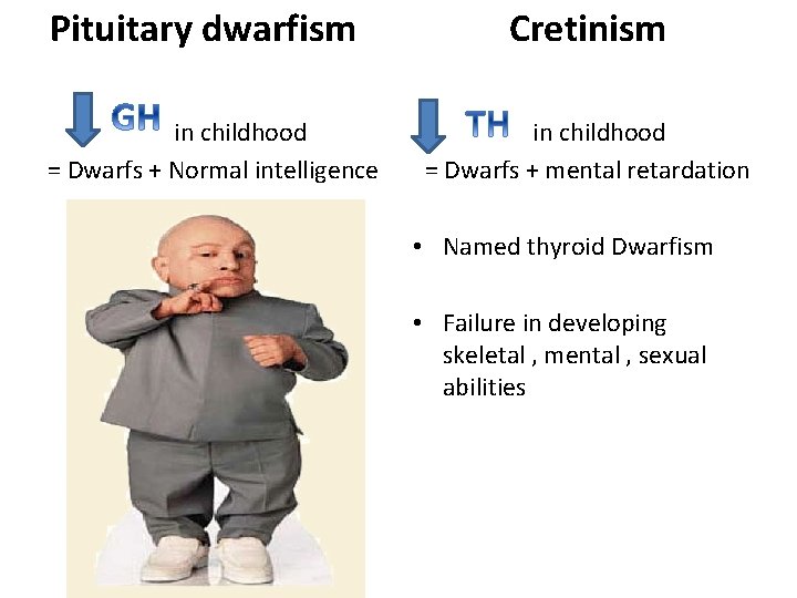 Pituitary dwarfism in childhood = Dwarfs + Normal intelligence Cretinism in childhood = Dwarfs