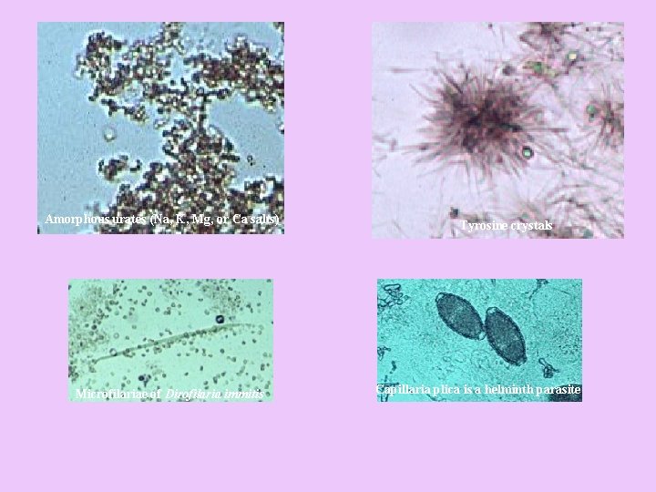 Amorphous urates (Na, K, Mg, or Ca salts) Microfilariae of Dirofilaria immitis Tyrosine crystals