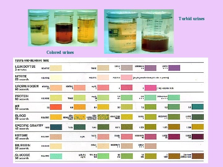 Turbid urines Colored urines 