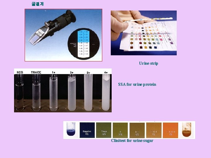 굴절계 Urine strip SSA for urine protein Clinitest for urine sugar 