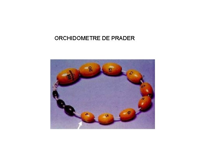 ORCHIDOMETRE DE PRADER 