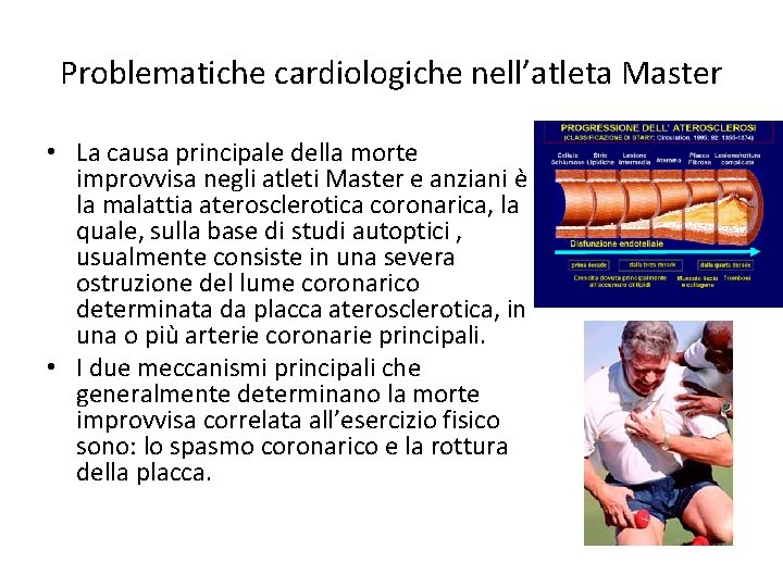 Problematiche cardiologiche nell’atleta Master • La causa principale della morte improvvisa negli atleti Master