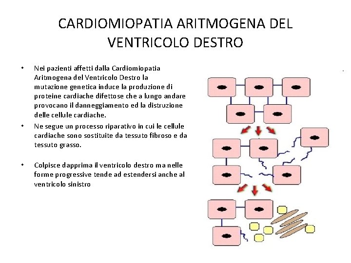 CARDIOMIOPATIA ARITMOGENA DEL VENTRICOLO DESTRO • • • Nei pazienti affetti dalla Cardiomiopatia Aritmogena