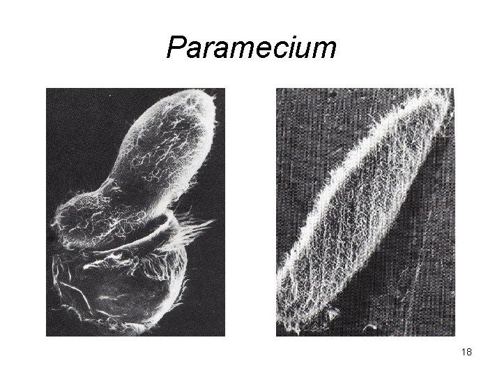 Paramecium 18 