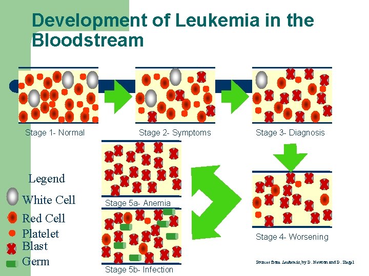 Development of Leukemia in the Bloodstream Stage 1 - Normal Stage 2 - Symptoms