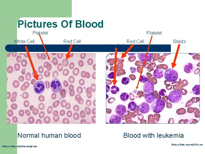 Pictures Of Blood Platelet White Cell Platelet Red Cell Normal human blood Sources from