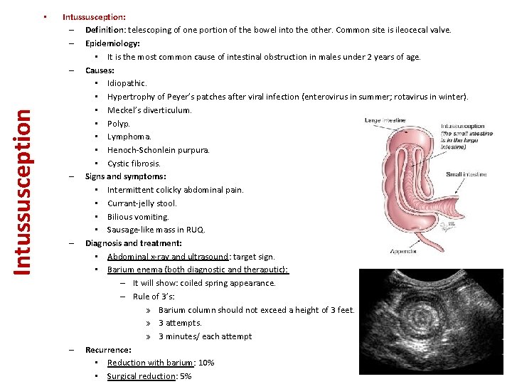 Intussusception • Intussusception: – Definition: telescoping of one portion of the bowel into the