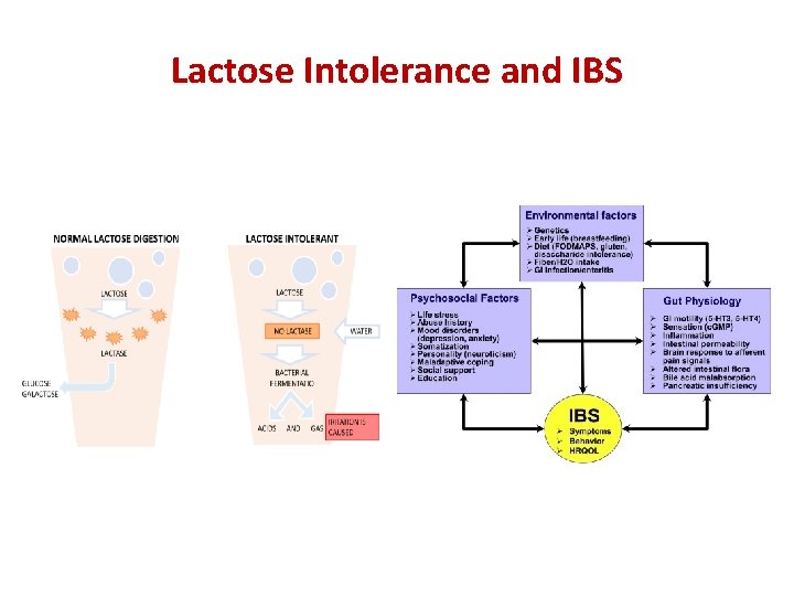 Lactose Intolerance and IBS 