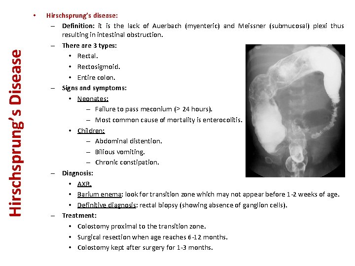 Hirschsprung’s Disease • Hirschsprung’s disease: – Definition: it is the lack of Auerbach (myenteric)