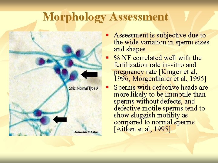 Morphology Assessment § Assessment is subjective due to the wide variation in sperm sizes