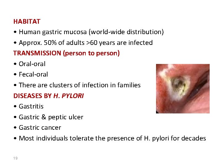 HABITAT • Human gastric mucosa (world-wide distribution) • Approx. 50% of adults >60 years